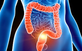 CANCERS COLORECTAUX