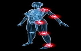 ARTHRITE SEPTIQUE